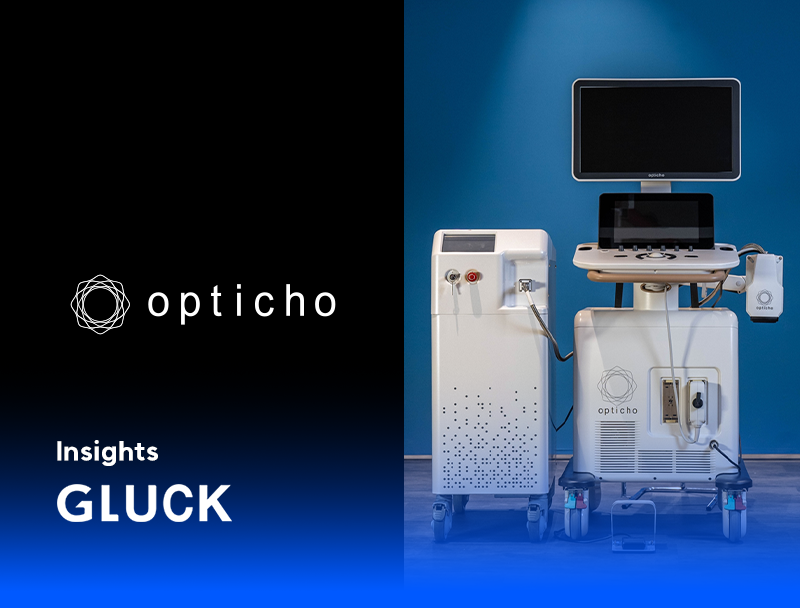 [월간글룩. 12월] 옵티코는 왜 3D프린팅 양산을 선택했을까? (실제 인터뷰 공개)