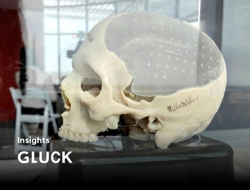 사라진 두개골의 절반, 3D프린팅으로 복원하다